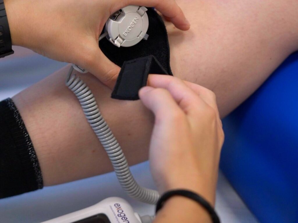 Aplikator Exogen przyłożony w opasce w okolicy złamania, obok urządzenie