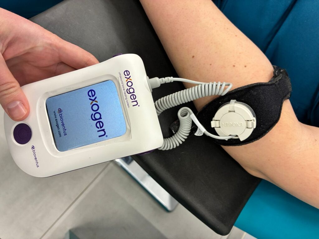 Exogen — głowica ultradźwiękowa umieszczona w opasce podczas zabiegu